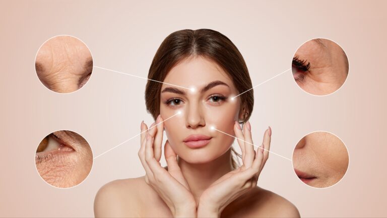 Collagen Botox Threads