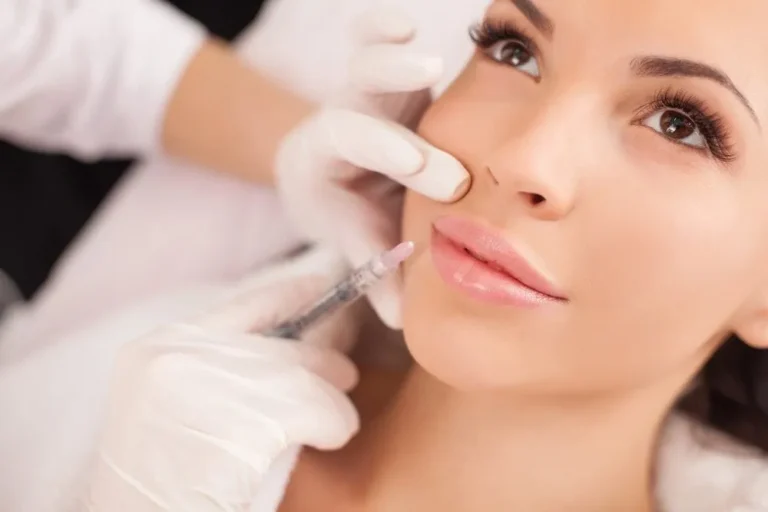 Hyaluronidase Dermal Filler Dissolving