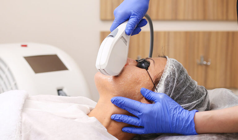 Face Vein Removal Treatment