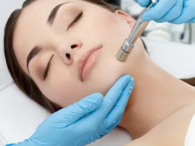 Microdermabrasion